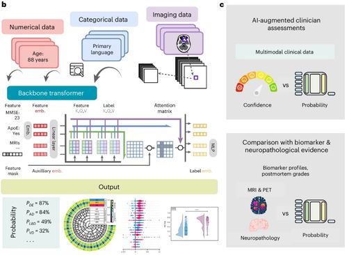 人工智能基础软件助力失智症快速诊断